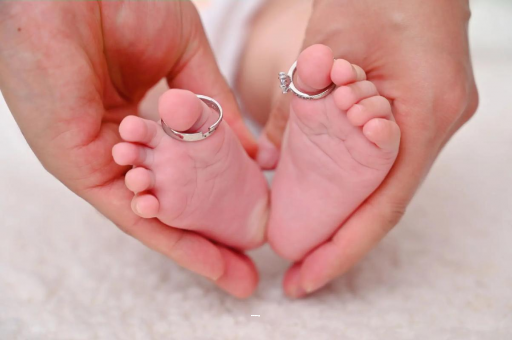 姜堰孕妇怎样预防妊娠纹